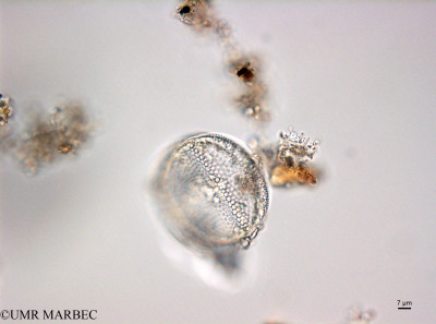 phyto/Bizerte/bizerte_bay/RISCO February 2015/Coscinodiscus spp (ancien Baie_T5_CWD1_Coscinodiscus160202_001_ovl-3).tif(copy)_thumb.jpg